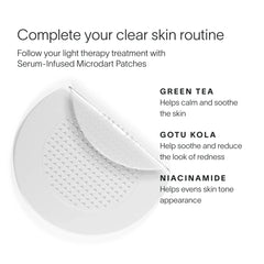 Bye Acne: 3-Minute Pimple Spot Treatment